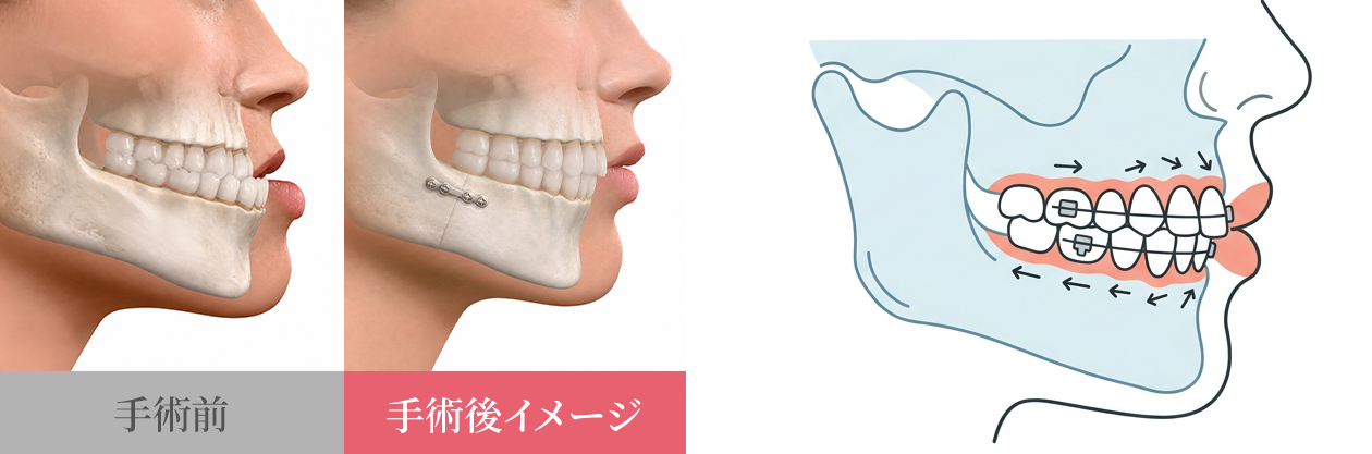 比較表